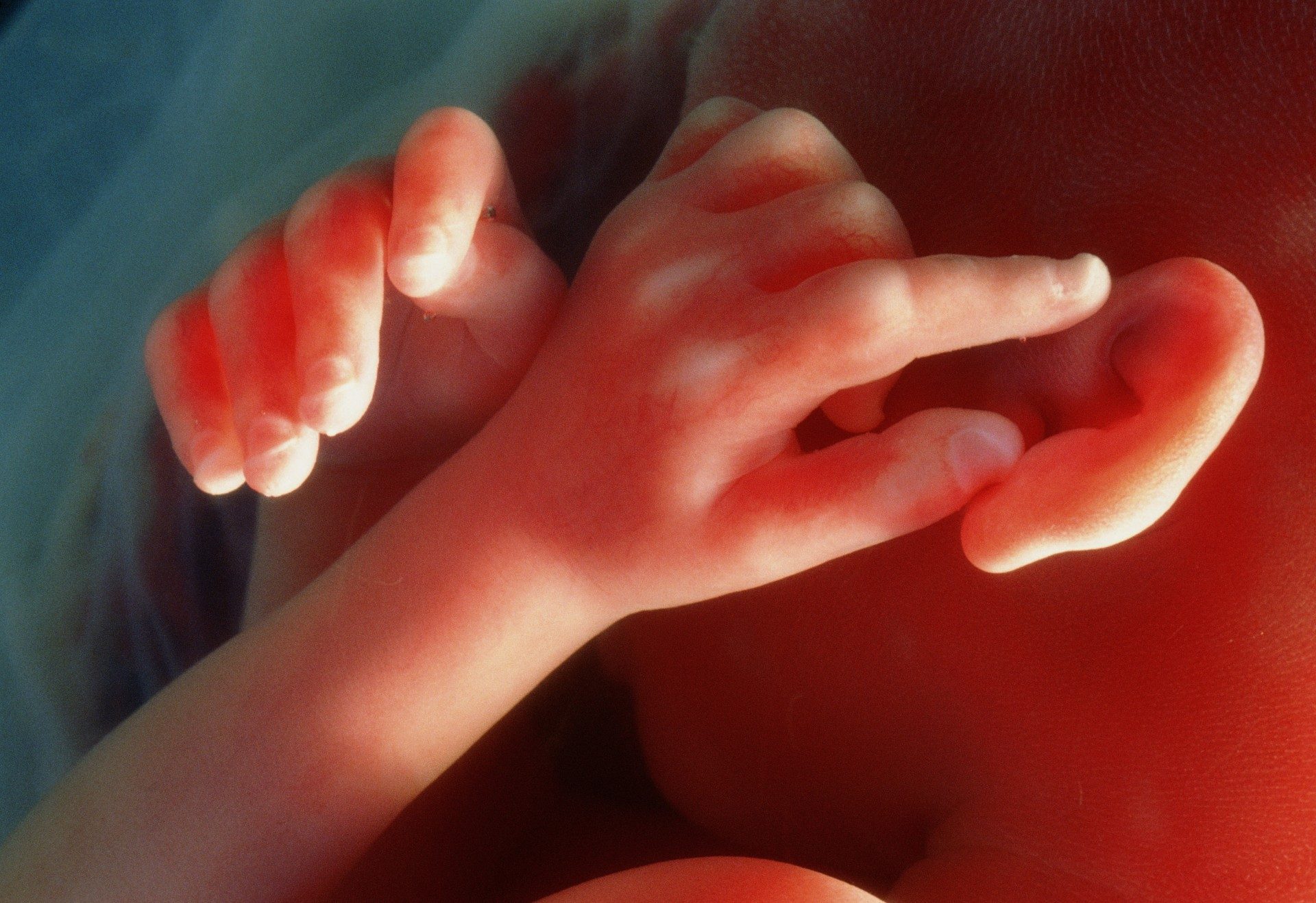 Unborn Babies, Children, Age Of Reason, And Eternal Life
